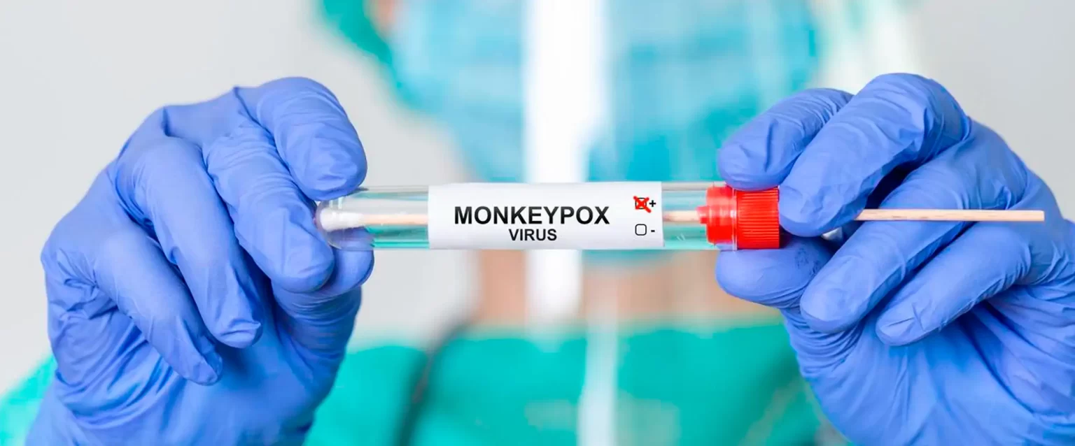 Monkeypox