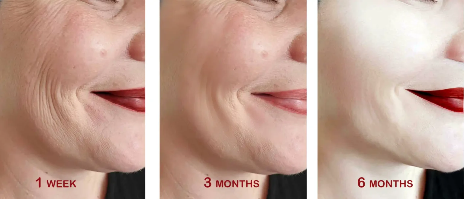 aging skincare